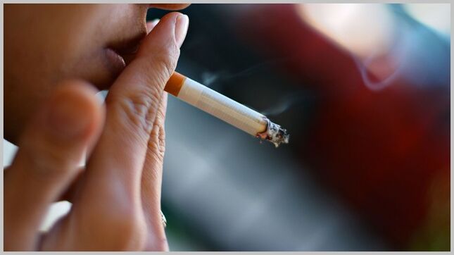Smoking as a cause of varicose veins development