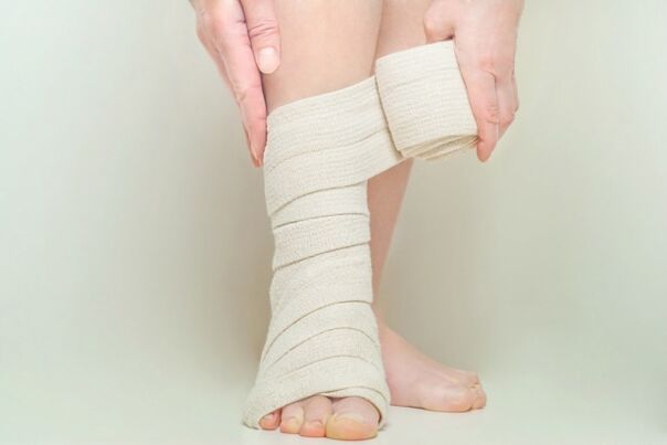 Compression bandage after varicose vein surgery