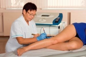 how to get rid of the treatment of varicose veins